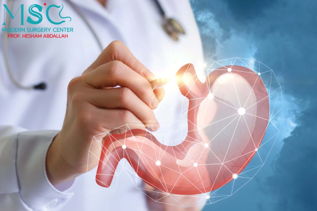 مميزات وعيوب عملية تحويل المسار