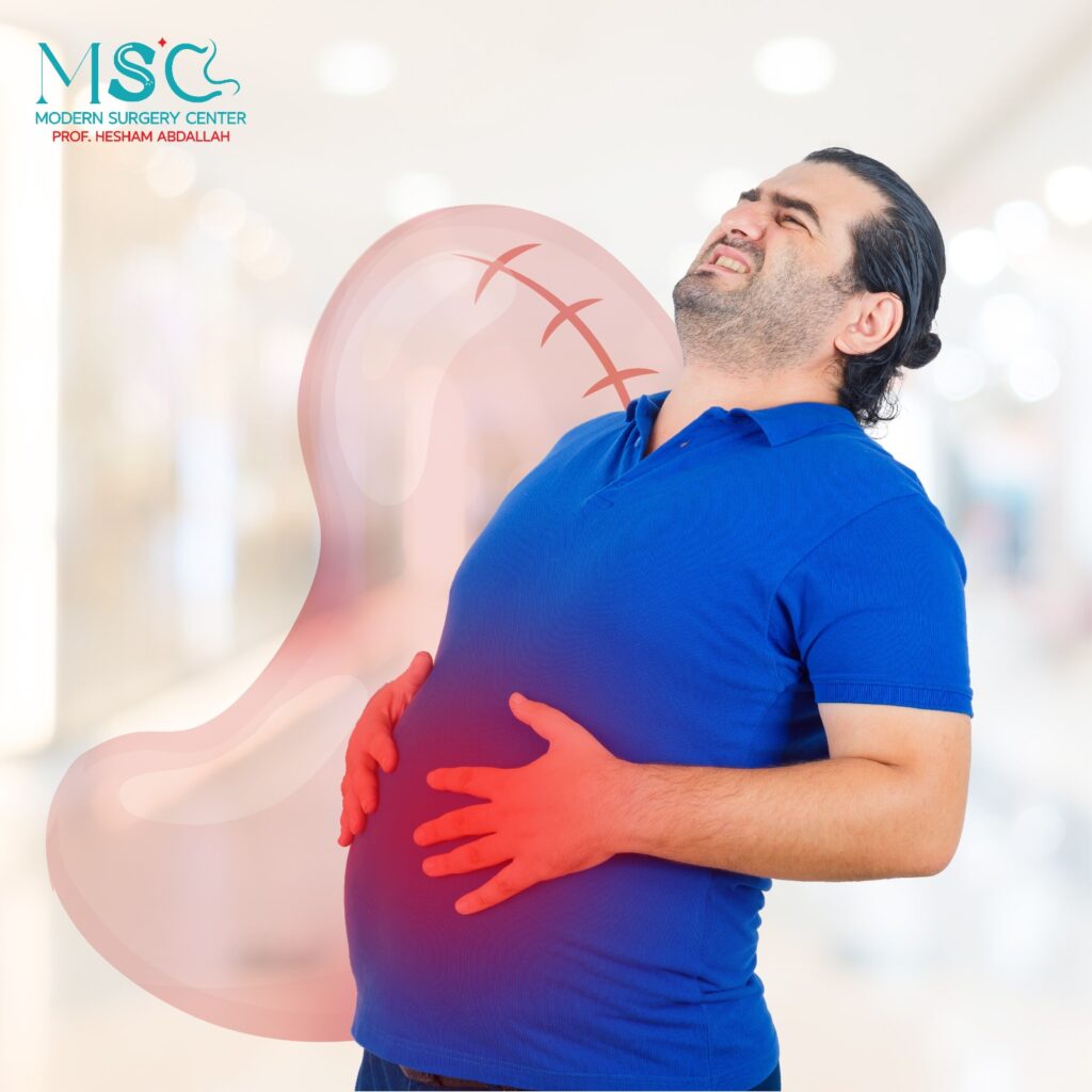 متى يزول خطر التسريب بعد التكميم