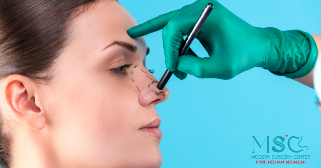 عمليات تجميل الانف الفاشلة