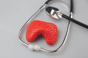 تضخم الغدة الدرقية